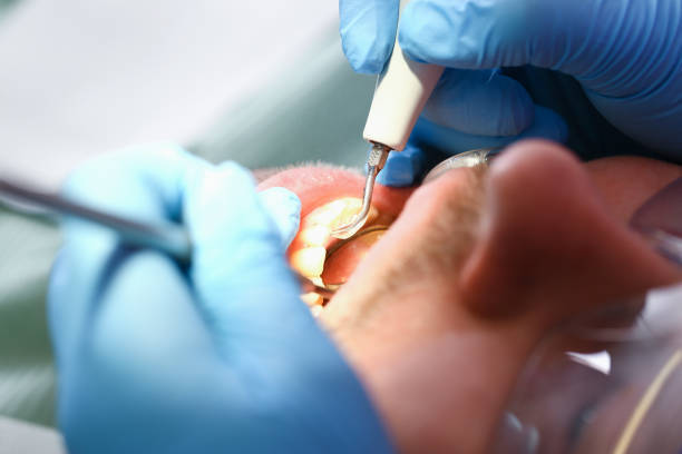Best Mobile Emergency Dentist in Bee Cave, TX